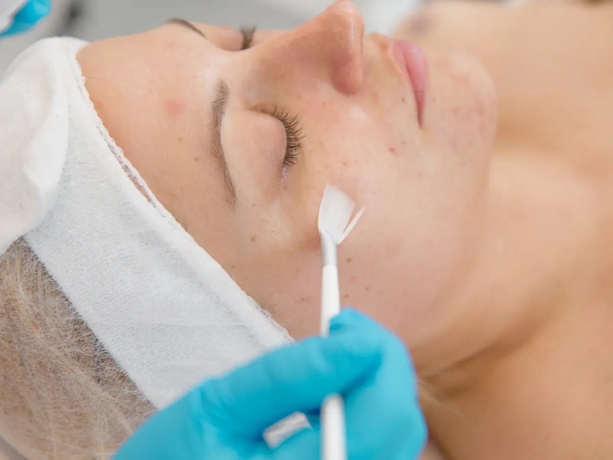 Glow Perfecting Plant Peel Eyes Treatment