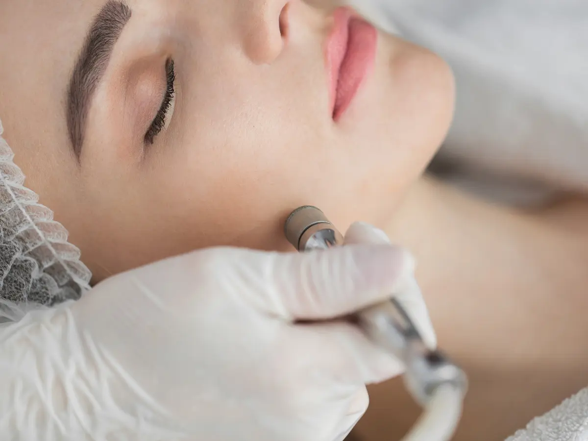 Microdermabrasion Facial Treatment